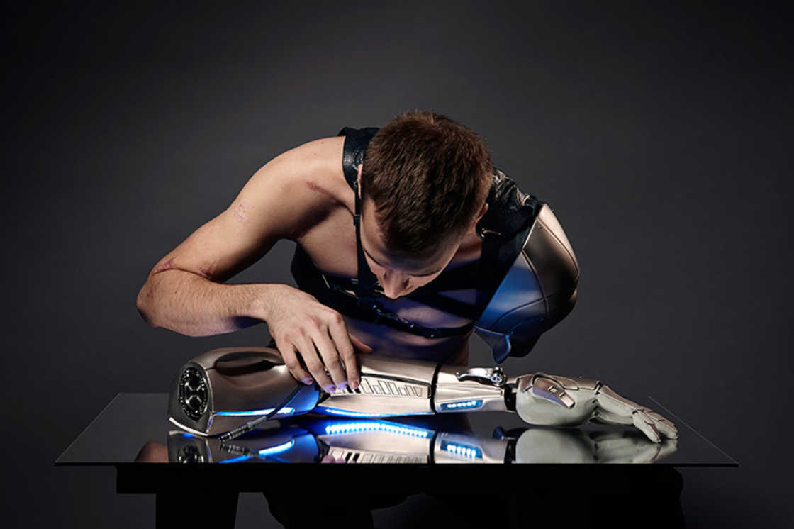 Amputee Gamer Gets A Bionic Arm With an Interactive Screen